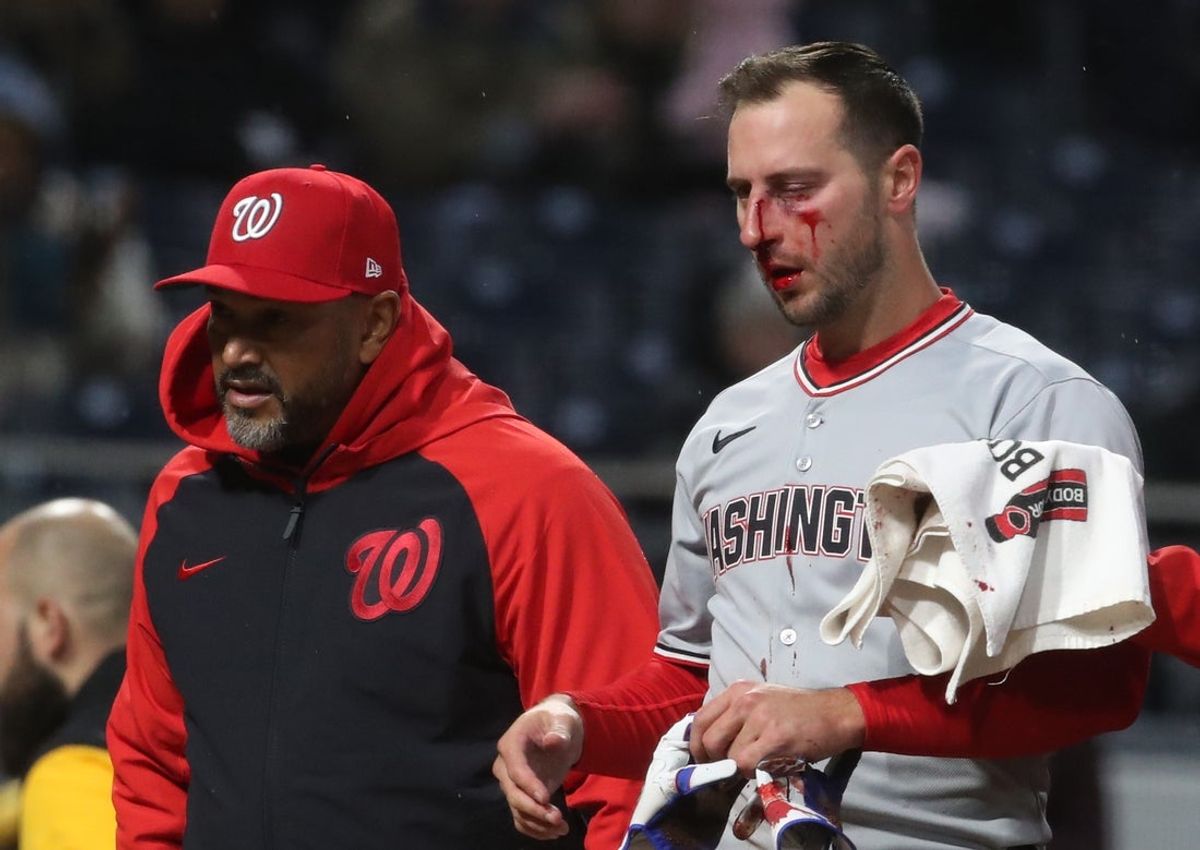 Apr 15, 2025; Pittsburgh, Pennsylvania, USA;  Washington Nationals third baseman Paul DeJong (14) leaves the field bloodied after being hit in the face by a Pittsburgh Pirates pitch during the sixth inning at PNC Park. Mandatory Credit: Charles LeClaire-Imagn Images