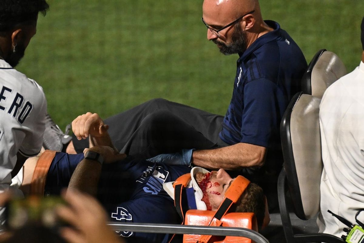 Jun 19, 2025; St. Petersburg, Florida, USA; (EDITORS NOTE: graphic image) Tampa Bay Rays  pitcher Hunter Bigge (43) gets medical attention after getting hit in the face by a foul ball  n the seventh inning against the Baltimore Orioles at George M. Steinbrenner Field. Mandatory Credit: Jonathan Dyer-Imagn Images