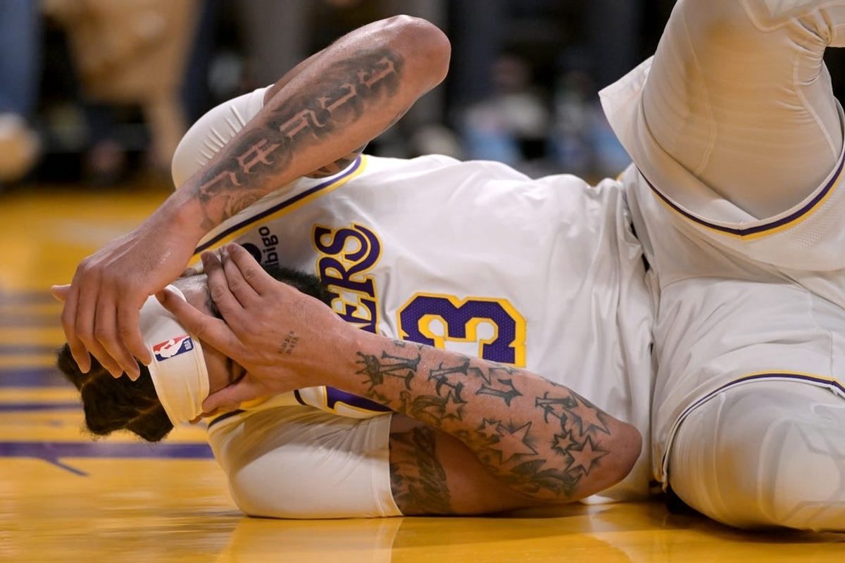 Apr 7, 2024; Los Angeles, California, USA;  Los Angeles Lakers forward Anthony Davis (3) covers his face after he was hit by Minnesota Timberwolves forward Kyle Anderson (1) going up for a dunk in the first half at Crypto.com Arena.
