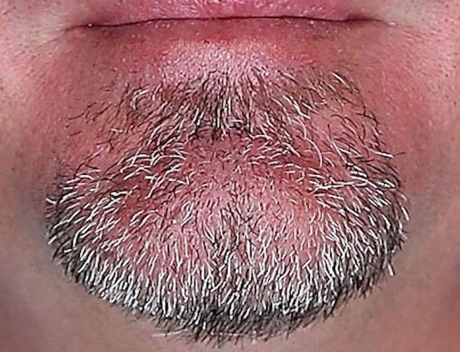 Whose Disgusting Baseball Chin Is This?