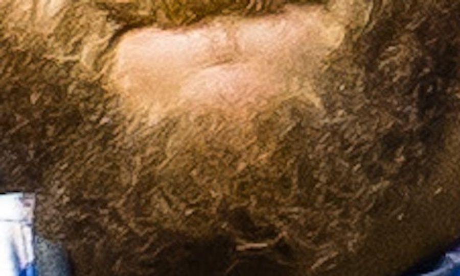 Whose Disgusting Baseball Chin Is This?