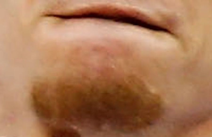 Whose Disgusting Baseball Chin Is This?