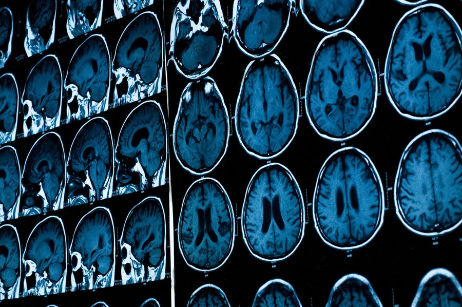 Report: Deceased Ohio State Football Player's Brain Will Be Examined