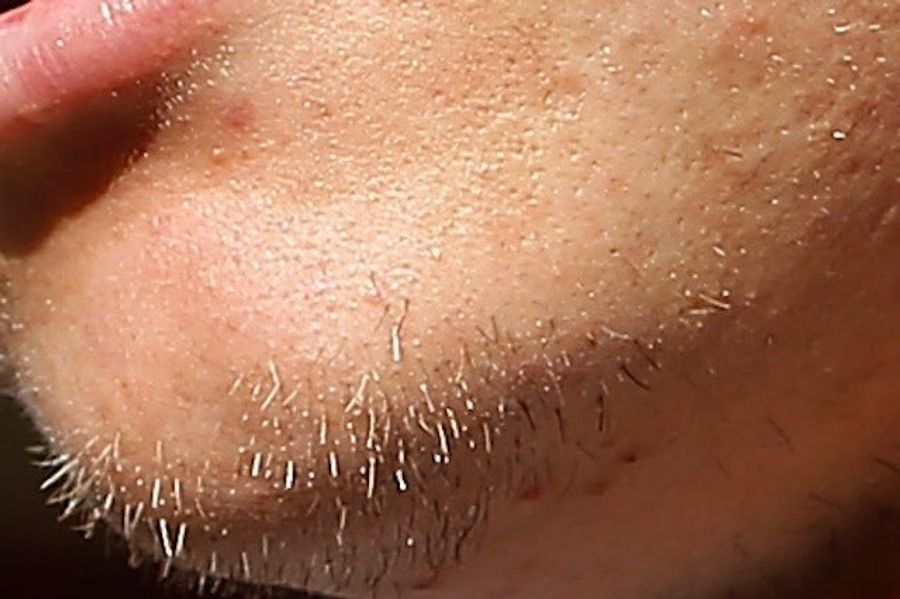 Whose Disgusting Baseball Chin Is This?