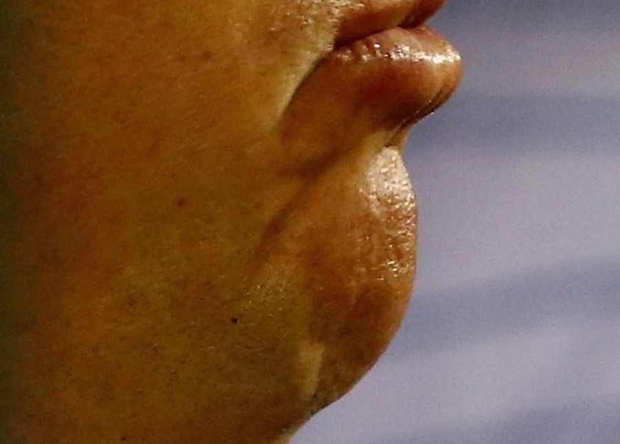 Whose Disgusting Baseball Chin Is This?