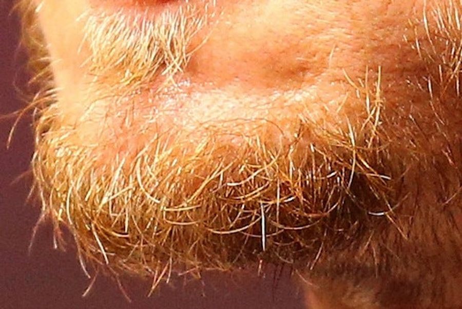 Whose Disgusting Baseball Chin Is This?