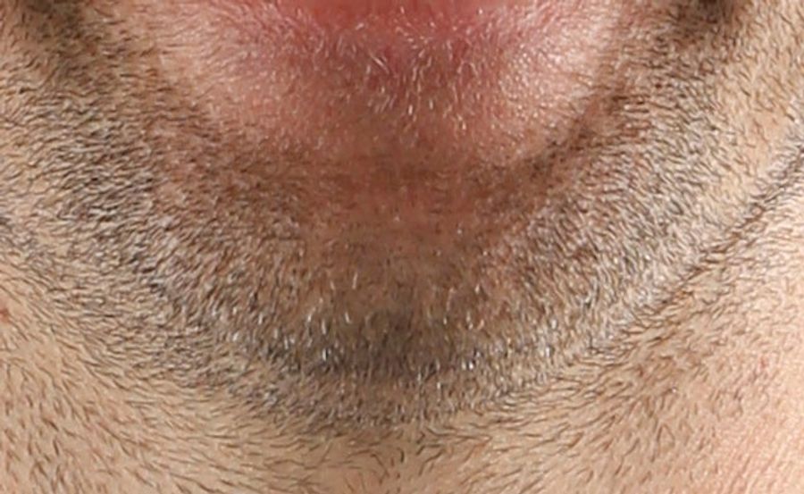 Whose Disgusting Baseball Chin Is This?