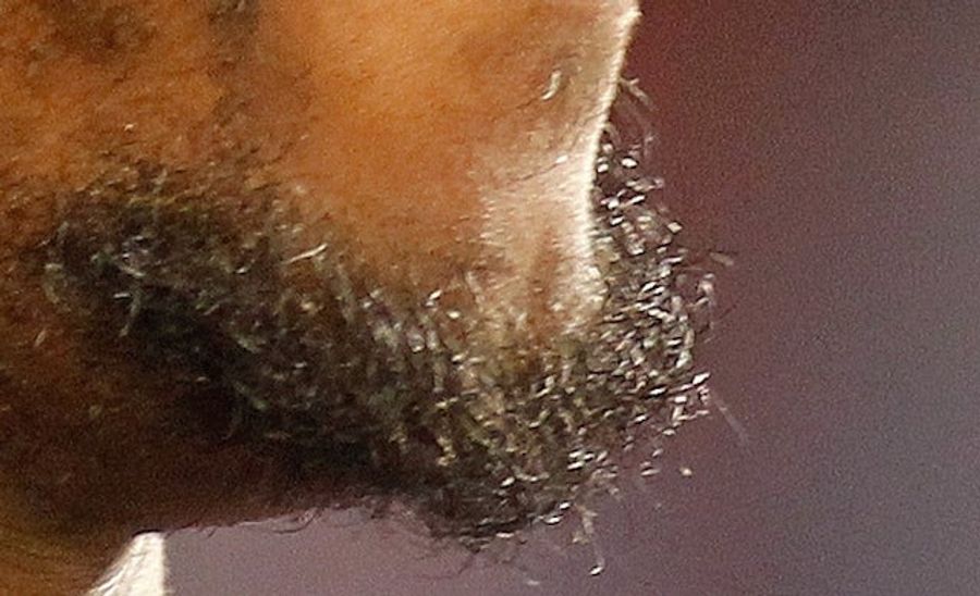 Whose Disgusting Baseball Chin Is This?