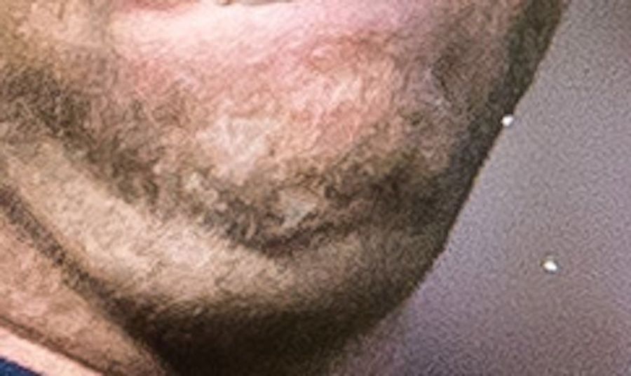 Whose Disgusting Baseball Chin Is This?