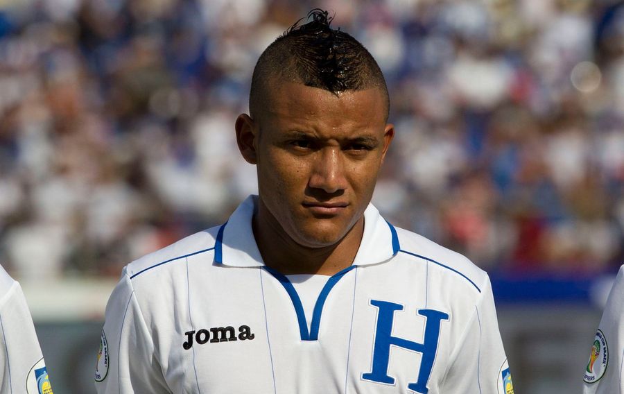 Honduras&#39; Luis Garrido Suffers Horror ACL And PCL Tear [WARNING: GRAPHIC]