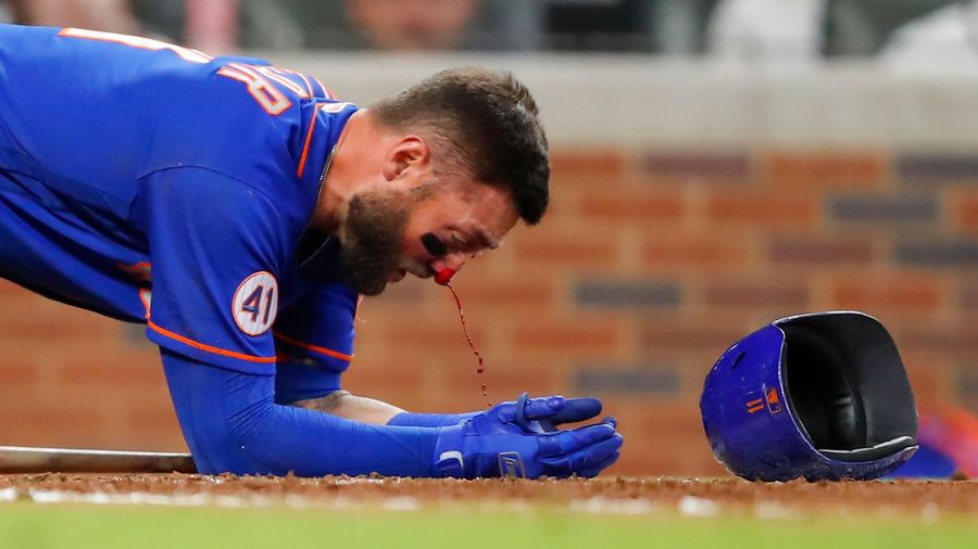 LOOK AWAY: Mets’ Kevin Pillar drilled in face by pitch, has multiple nasal fractures