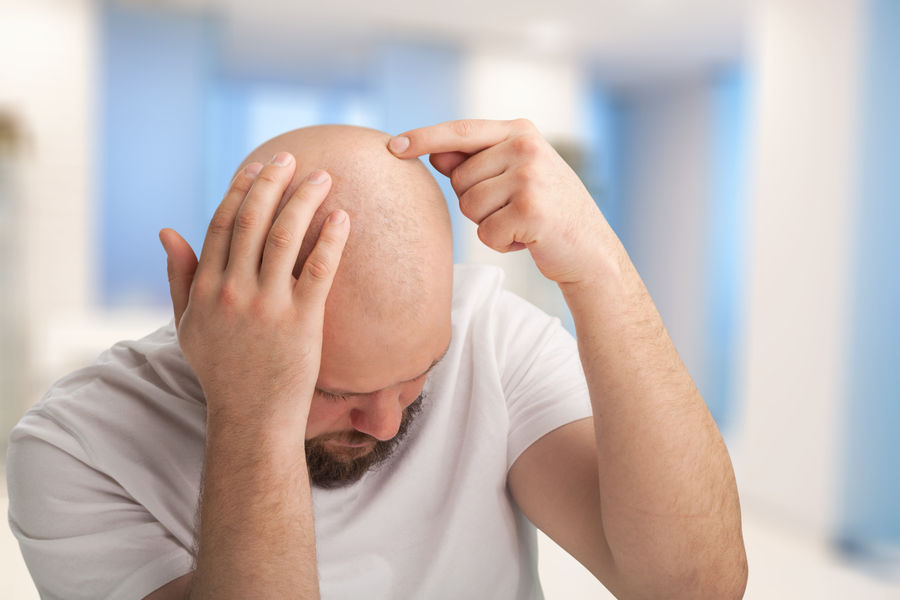 This type of beverage could accelerate hair loss, according to science