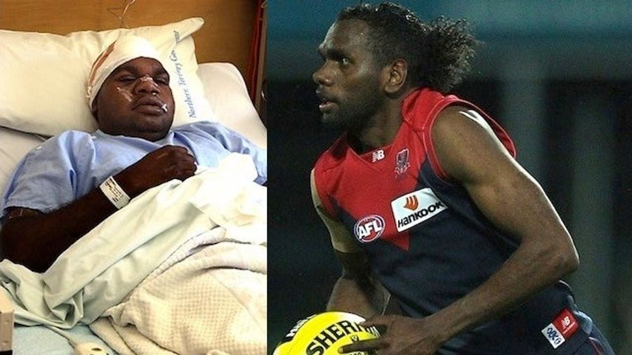 Australian Footballer Requests Time Off For &quot;Family Issues,&quot; Attacks Cousin With A Machete