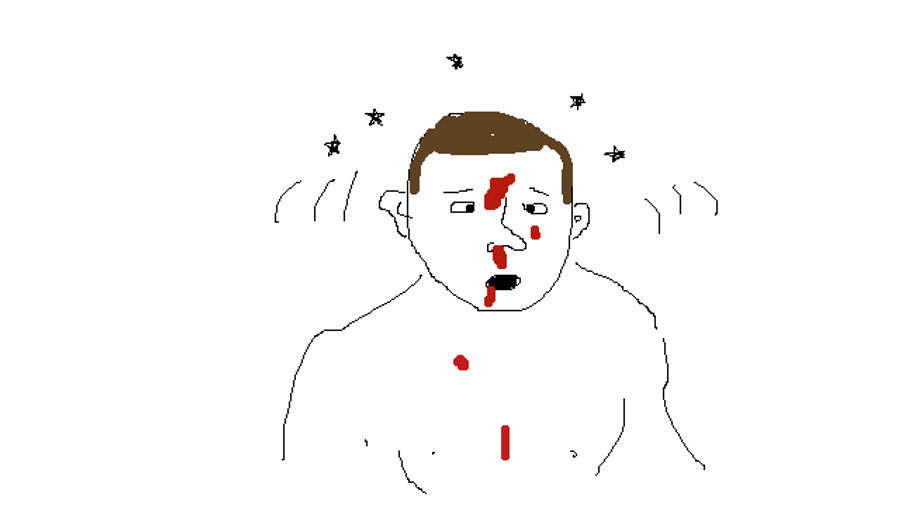 Ben Henderson Severely Messed Up Frankie Edgar's Face En Route To Winning The UFC Lightweight Belt
