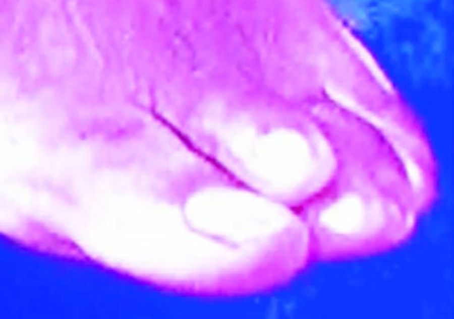 Here, Stare At Deion Sanders's Freak Toe For A While