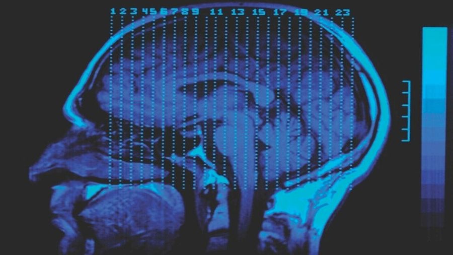 Don&#39;t Buy These Untested Products Promising &quot;Concussion Relief In A Bottle&quot;