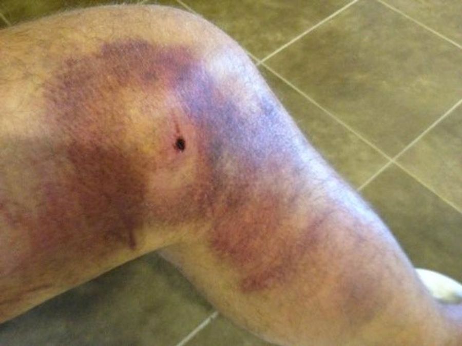 Gross Photo Evidence You Don't Want To Be A Hockey Player