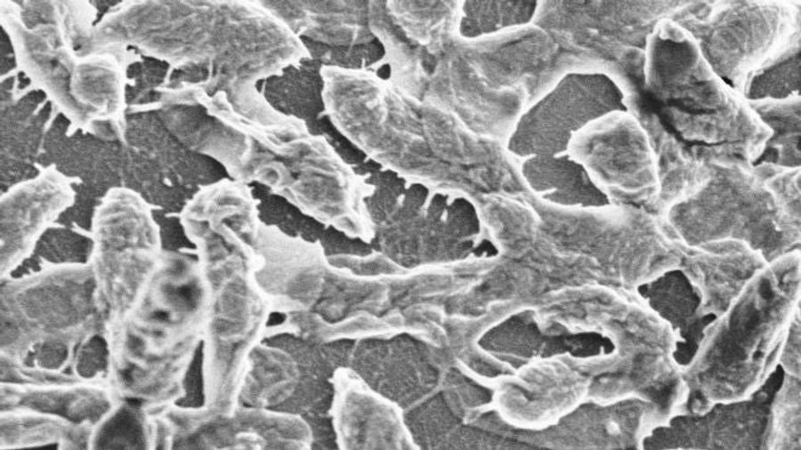 Gangrenous, Flesh-Eating Penis Infection Results In Most Harrowing Paragraph Ever