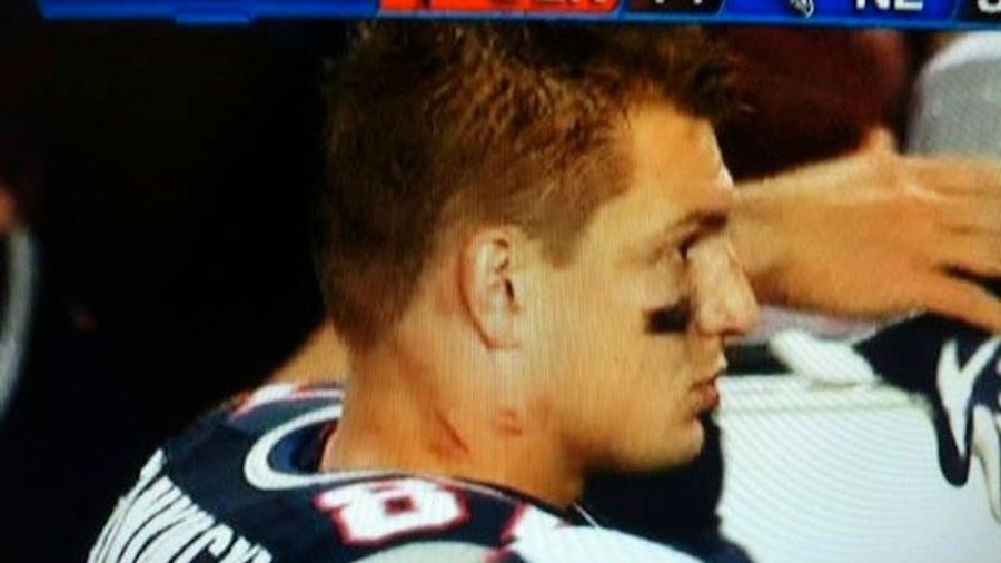 That Sure Looks Like A Pair Of Vicious Hickeys On Rob Gronkowski's Neck