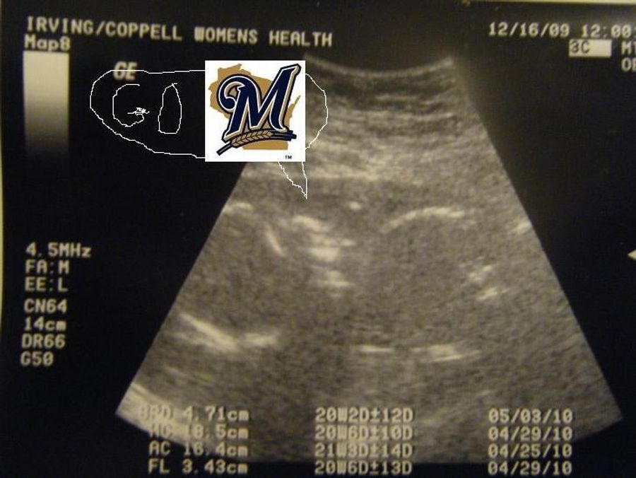 The Mailbag Demands You Name The Brewer Baby