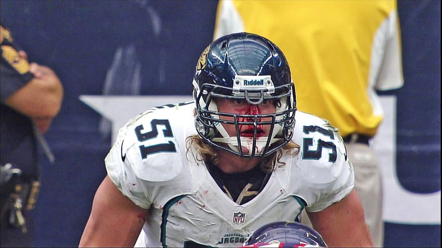 Paul Posluszny Has The Face Of A Football Player