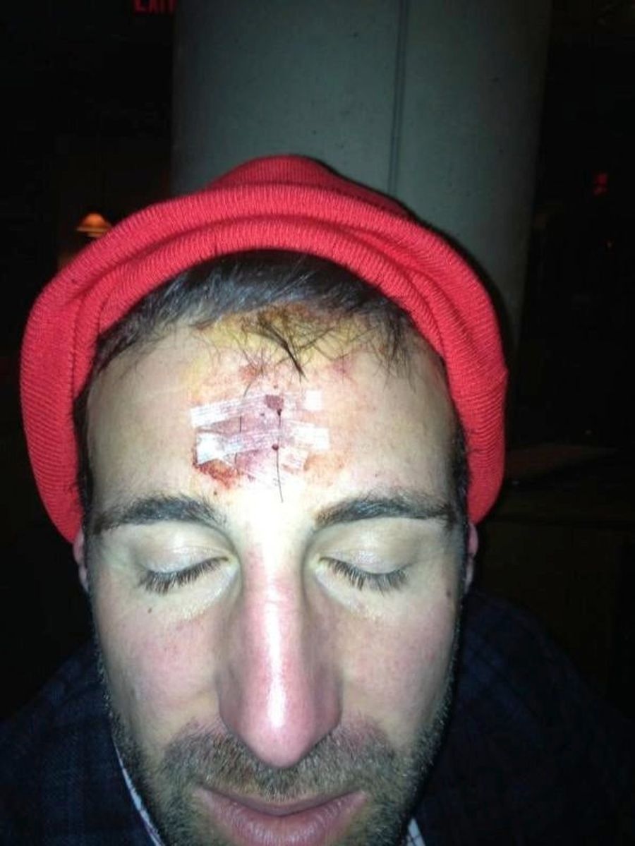 A Message From Mike Vrabel's Stitched-Up Forehead: Always Wear A Helmet When Head-Butting People Wearing Helmets