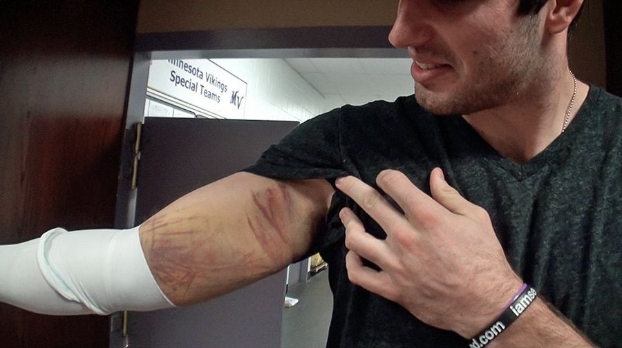 Injured Christian Ponder Couldn&#39;t Throw The Ball Farther Than 10 Yards