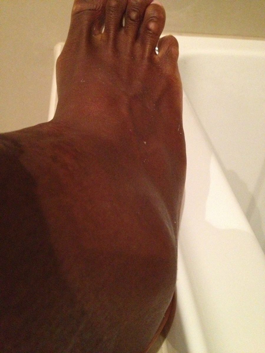 This Is What Serena Williams&#39;s Ankle Looks Like