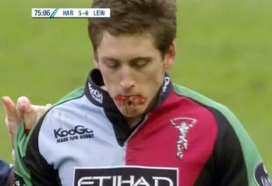 Bloodgate Widens: Doctor Admits Slicing Player&#39;s Lip To Fake Injury