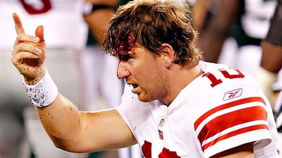 Eli Manning Gets Bloodied