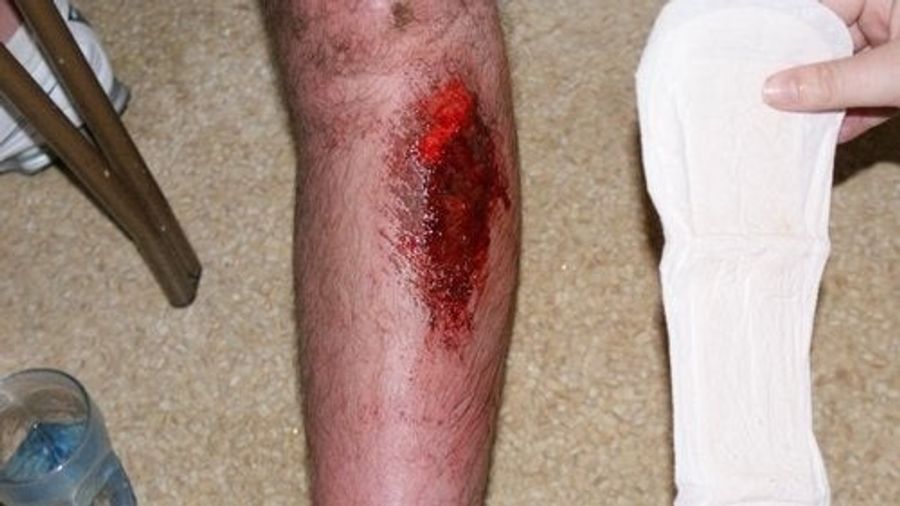 Blood Writes: Man Slides Into Third And Winds Up Wearing A Maxi Pad