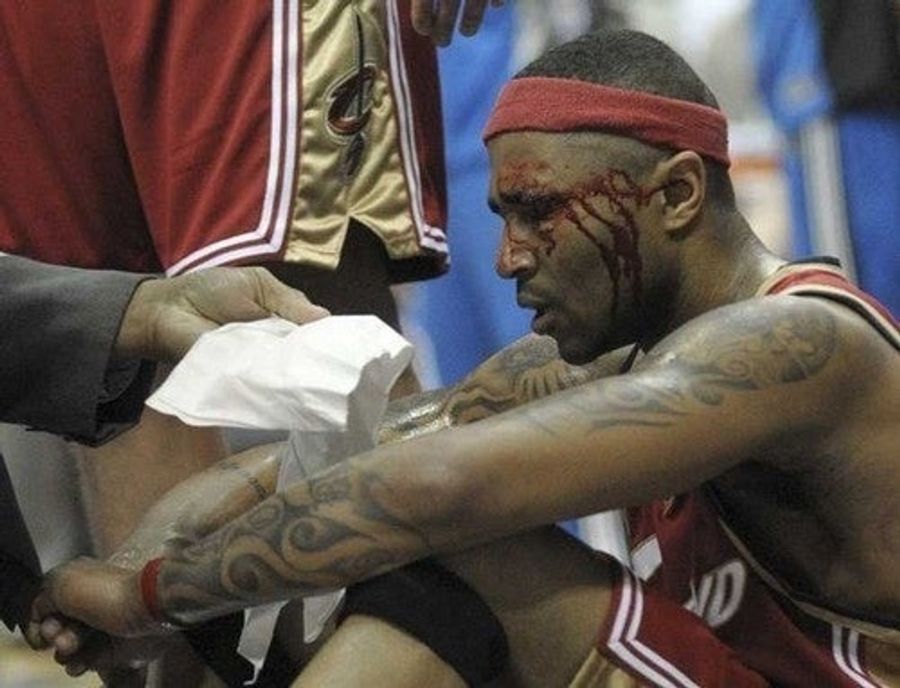 LeBron Watch, Day 2: No, Seriously, Mo Williams Runs A Pit Bull Business