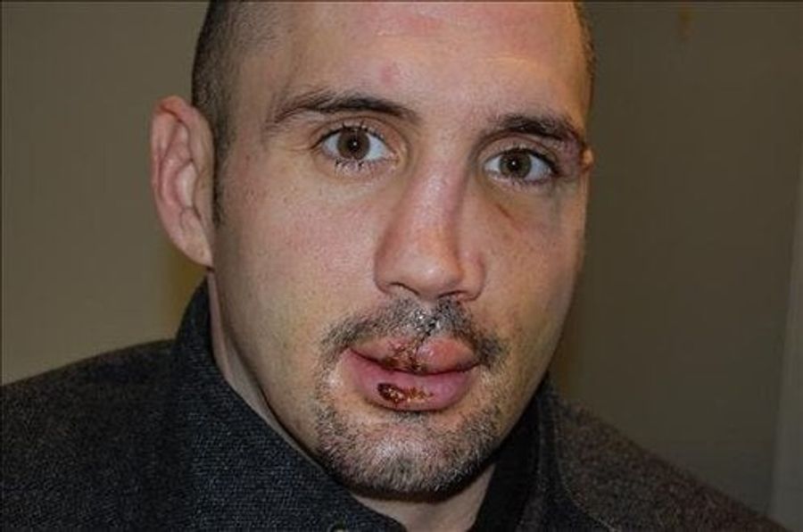Tooth Fairy Turns To NHL Gold Mine