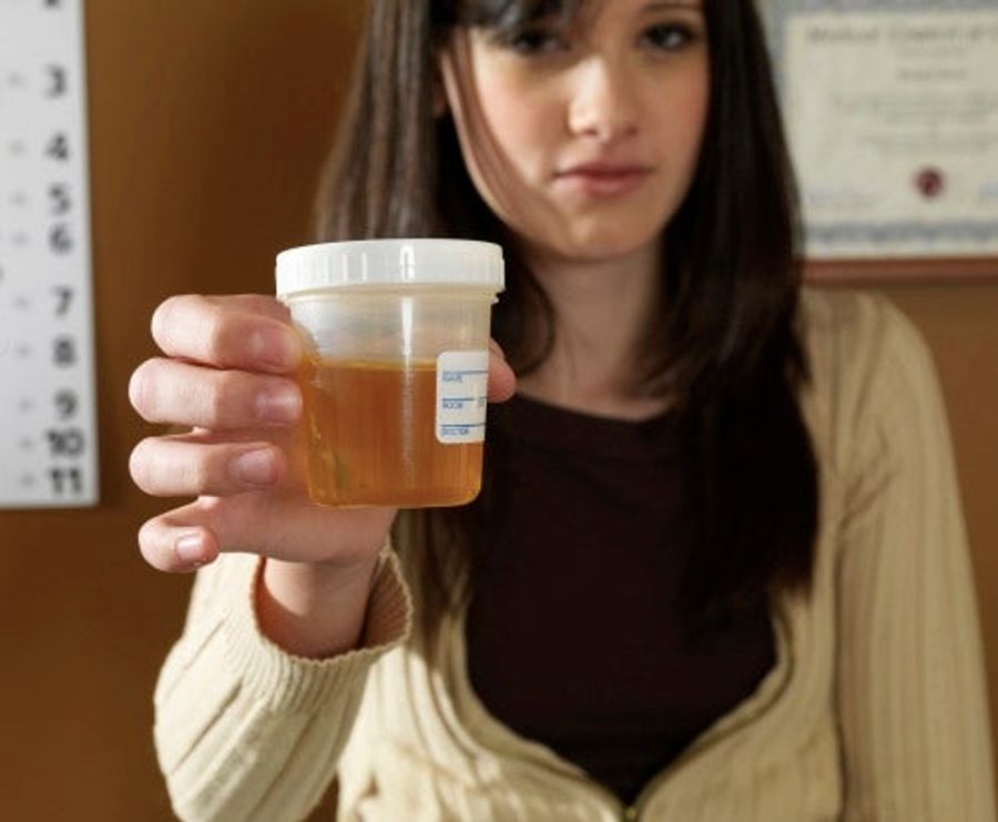Some Sports Test For Steroids; Others Only Care If You&#39;re Dealing