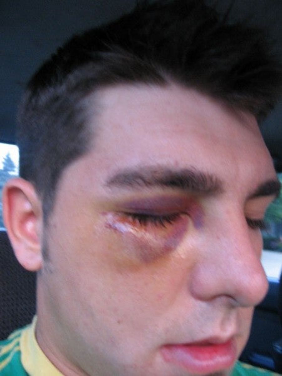Black Eyes, Skinned Knees, And A Pitiful Excuse For A Man