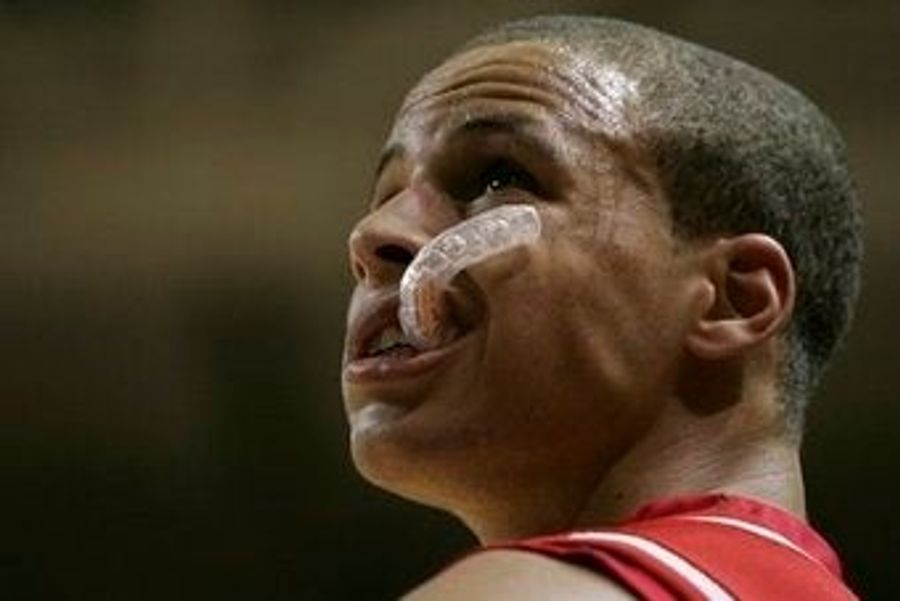 Is This The End Of Stephen Curry?