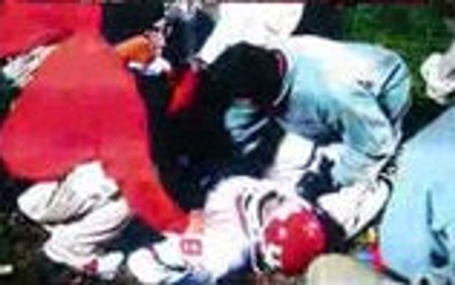 Houston, We Have A Compound Fracture