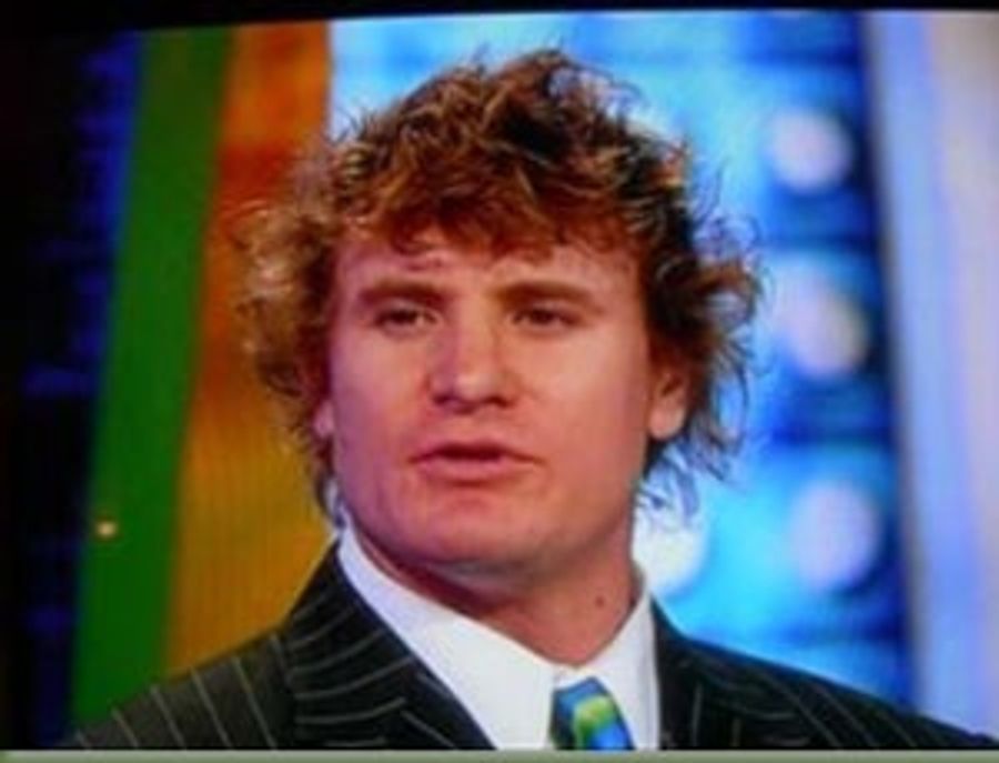 Eric Byrnes' Hair Isn't The Problem: YOU ARE