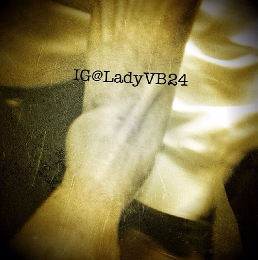 Here&#39;s A Weird Picture Of Kobe Bryant&#39;s Swollen Ankle