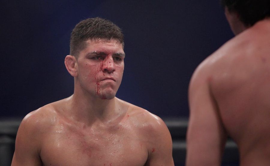 Nick Diaz Doesn't Pay His Taxes, Is A Crazy Person