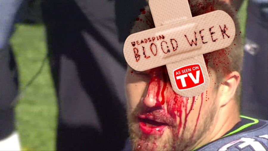 Body Parts Do Not Bend That Way: Gruesome Sports Injuries As Seen On TV