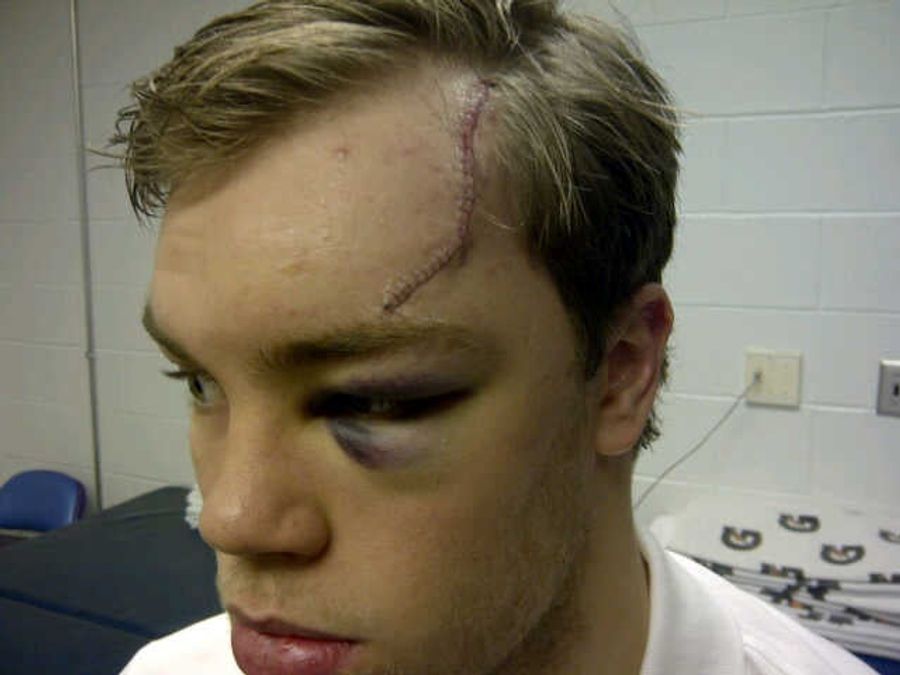 We Can Rebuild Taylor Hall