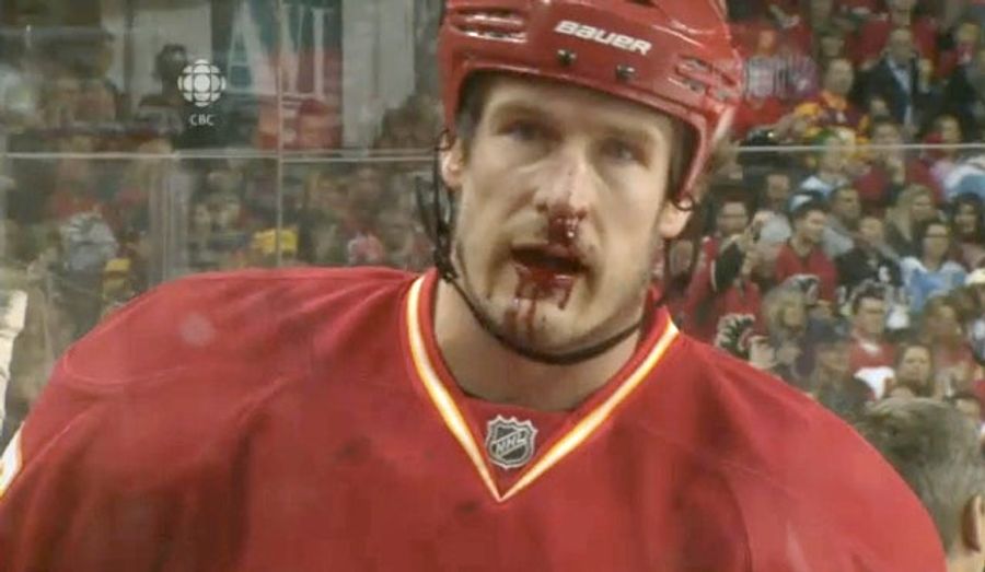 Here's Your First Bloodied-Face Picture Of The New NHL Season