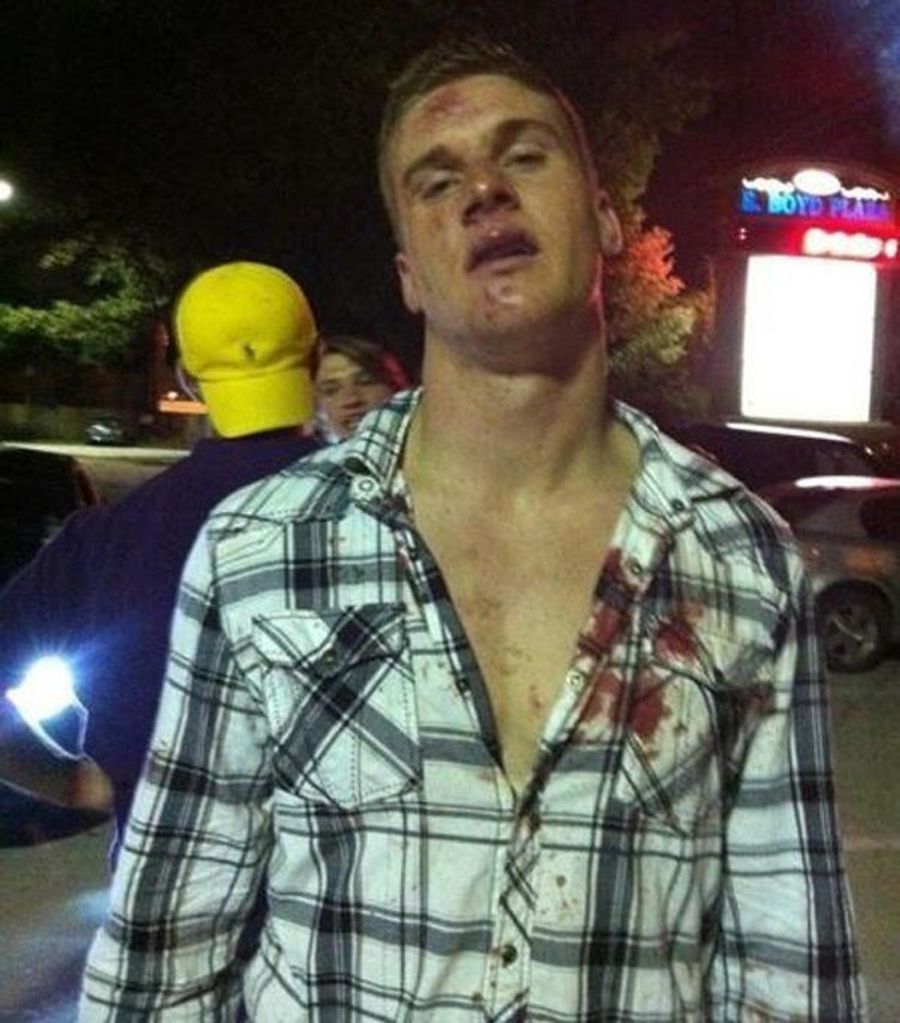 Wow, LSU Players Really Fucked Up Those Guys In The Shady's Parking Lot (Allegedly)