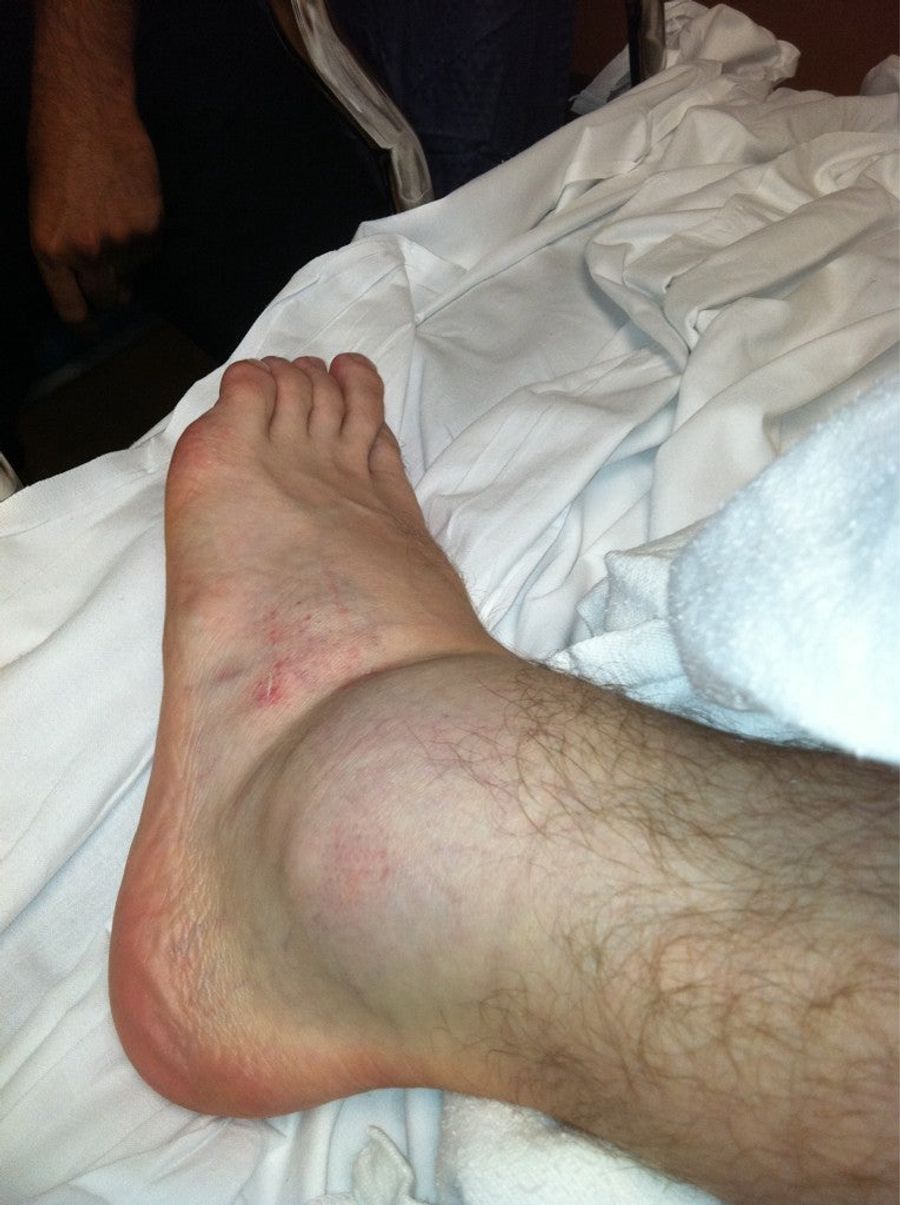 In Which Sport Can You Win Despite This Grotesquely Swollen Ankle?