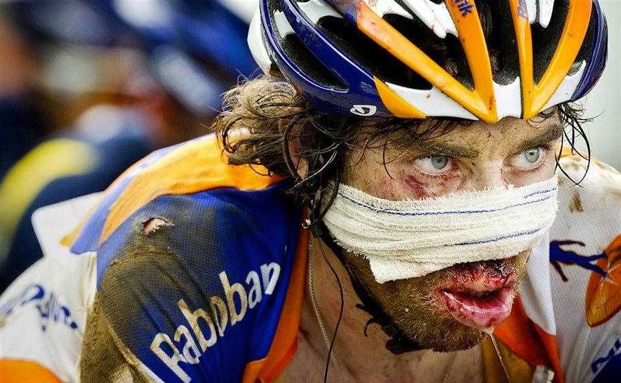 Hamburger Face Won't Keep This Tour De France Rider Down