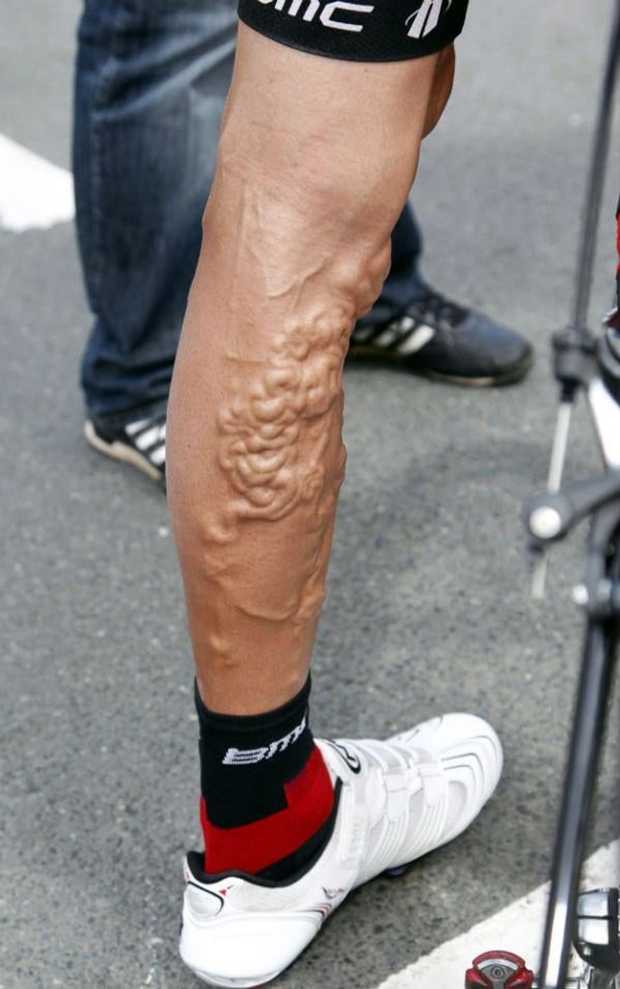 This Is Your Leg. This Is Your Leg On Cycling.