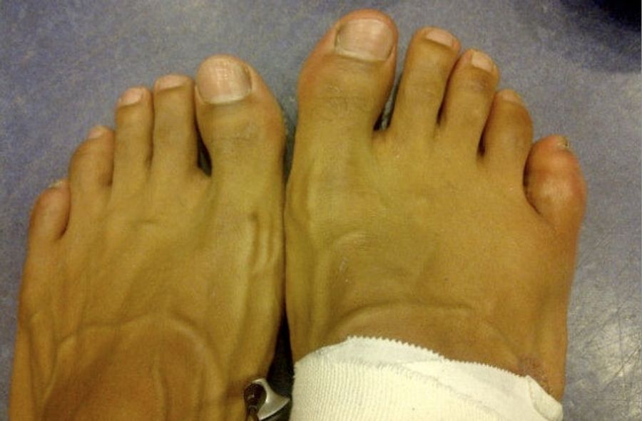 This Little Piggy Is David Haye's Excuse For Getting His Ass Kicked Last Night