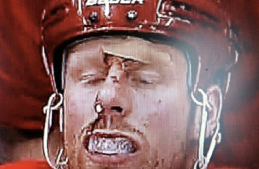 Johan Franzen's Face Is A Sight To Behold
