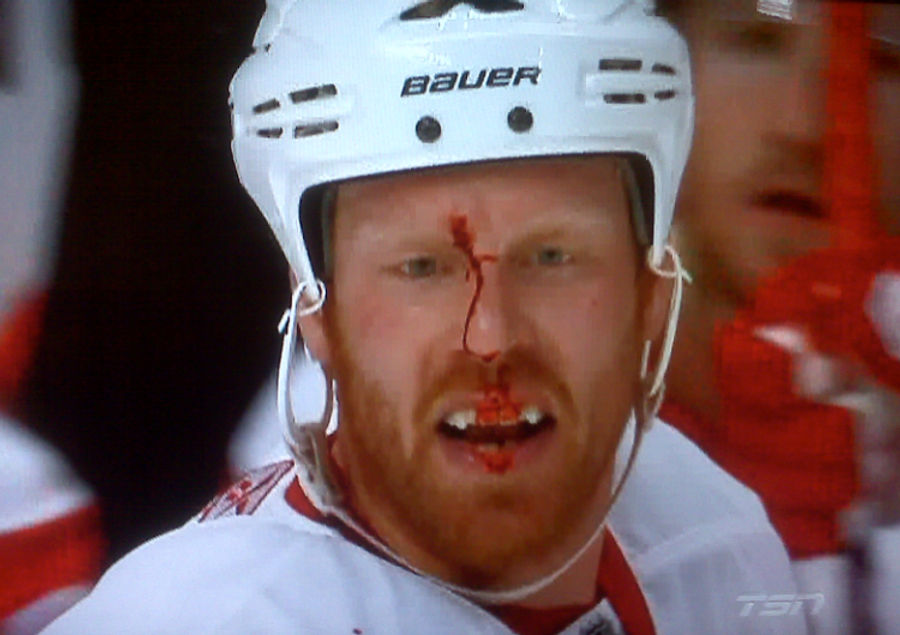 NHL Playoff Blood Flows Red On The Regular-Season Rink